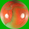 Unidentified Marbles 3020